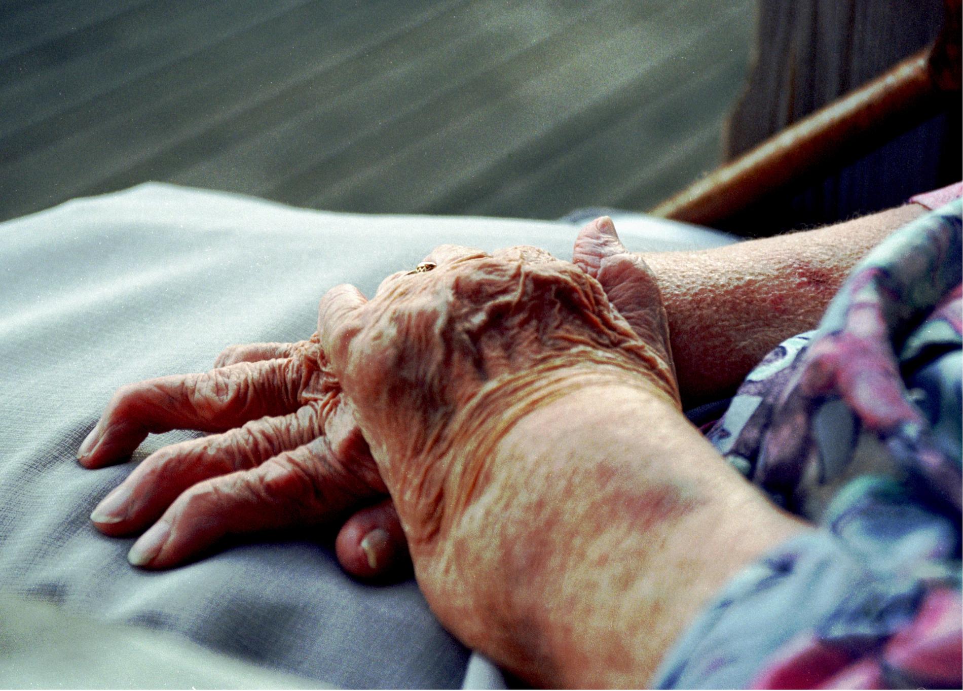 Äldre kvinna med reumatism.
