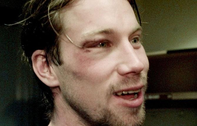 HJÄRNSKAKNING I februari 2000 drabbas Forsberg av en hjärnskakning i en match mot Vancouver. Smällen gör att han missar All Star-matchen.