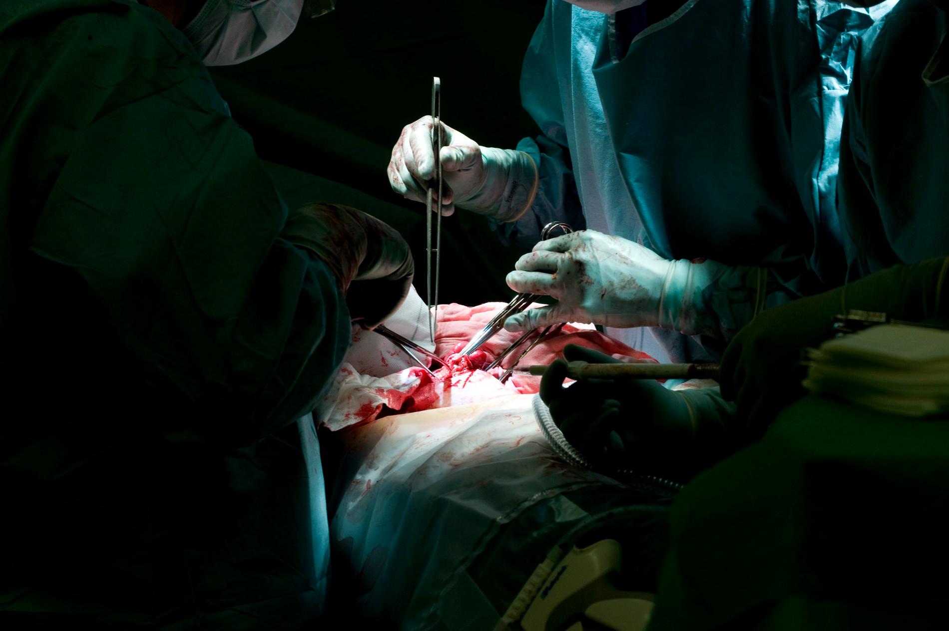 En plastikkirurg blir av med legitimationen. Arkivbild. Operationen på bilden har inte med läkaren att göra.