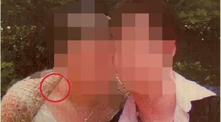 BEVISET. Bröllopsfotot visar ett stort rött märke på kvinnans hals. Spår av en misshandel.