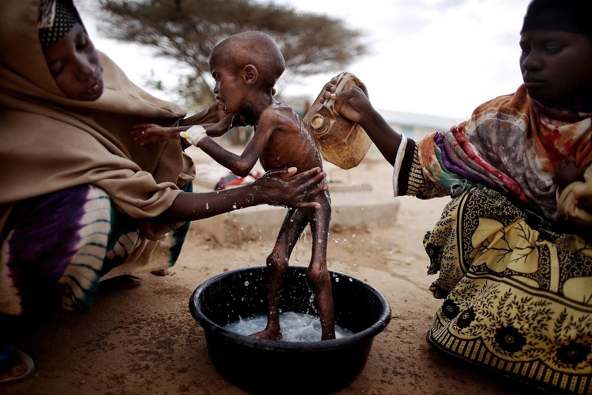 MELLAN LIV OCH DÖD  Situationen i Östafrika är extrem. Den värsta svältkatastrofen i världen på 60 år har drabbat 12 miljoner människor. I flyktinglägret i Dadaab i nordöstra Kenya bor nu en halv miljon flyktingar. Lägret är dimensionerat för att klara av 90 000 människor. Abdilfatah, 2, och hans mamma kom hit när de flydde från torkan och kriget i Somalia. Pojken svävar mellan liv och död efersom hans kropp har glömt bort vad den ska göra med mat.