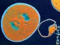 Så ser den ut – bakterien MRSA.