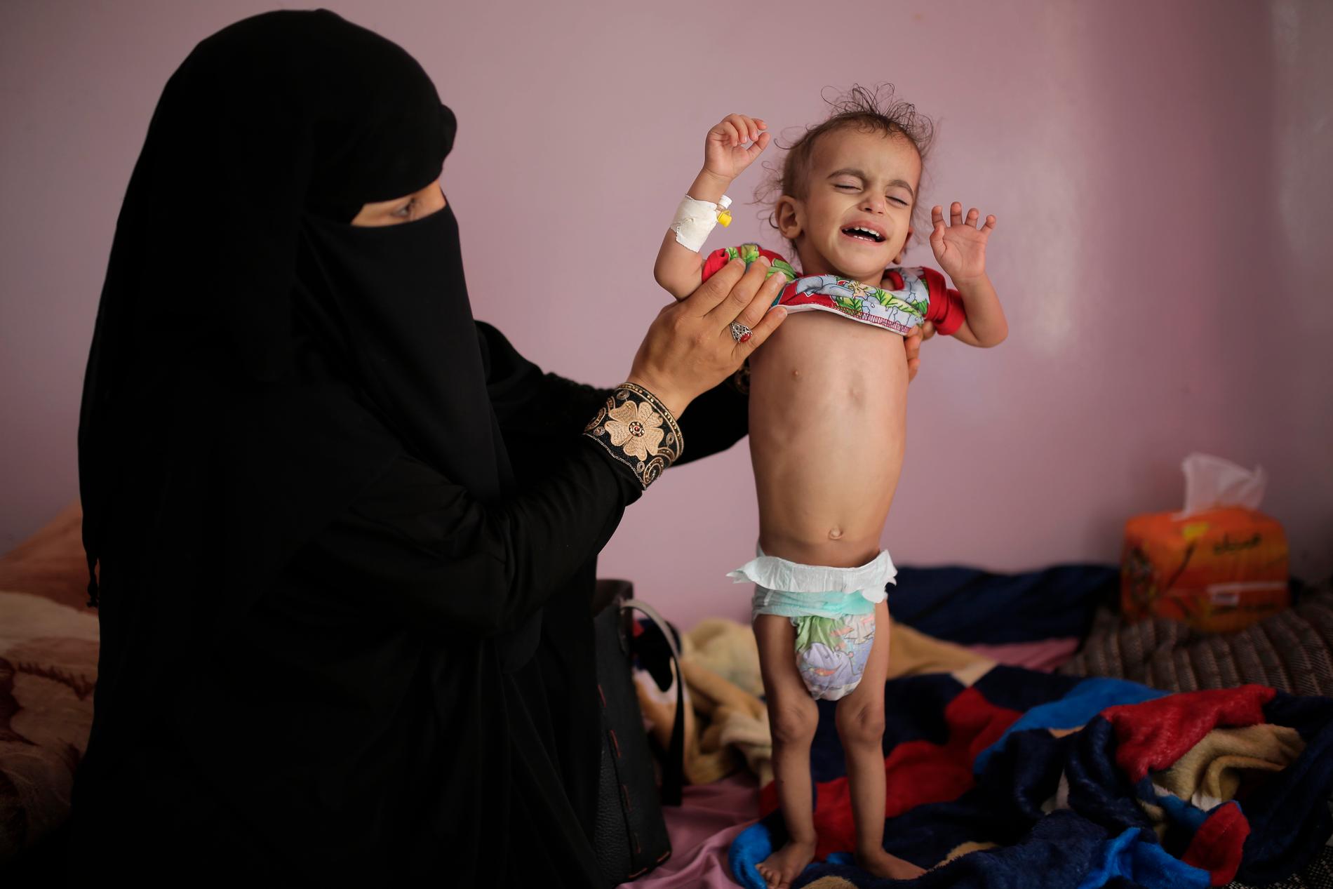 En kvinna i Jemen håller upp sin undernärda son. Arkivbild
