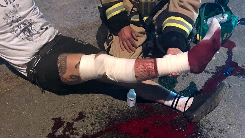 Christoffer sparkade in en ruta, för att ta sig in och varna boende för branden. Han skadades i samband med det och åkte ambulans till sjukhuset och fick sy 16 stygn.