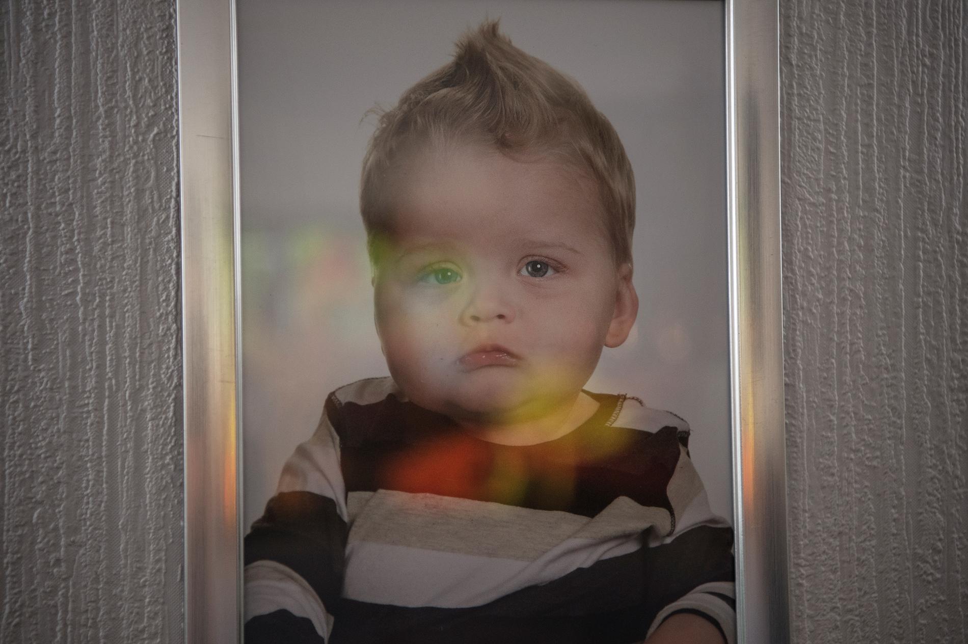 När Cimon var fem månader gammal upptäcktes att allt inte stod rätt till. Han har en genmutation som orsakat hans svåra hjärnskador och epilepsi. Cimon är ett av endast sex dokumenterade fall i världen.