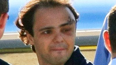 Utskriven Felipe Massa har fått lämna sjukhuset i Brasilien. FOTO: STR
