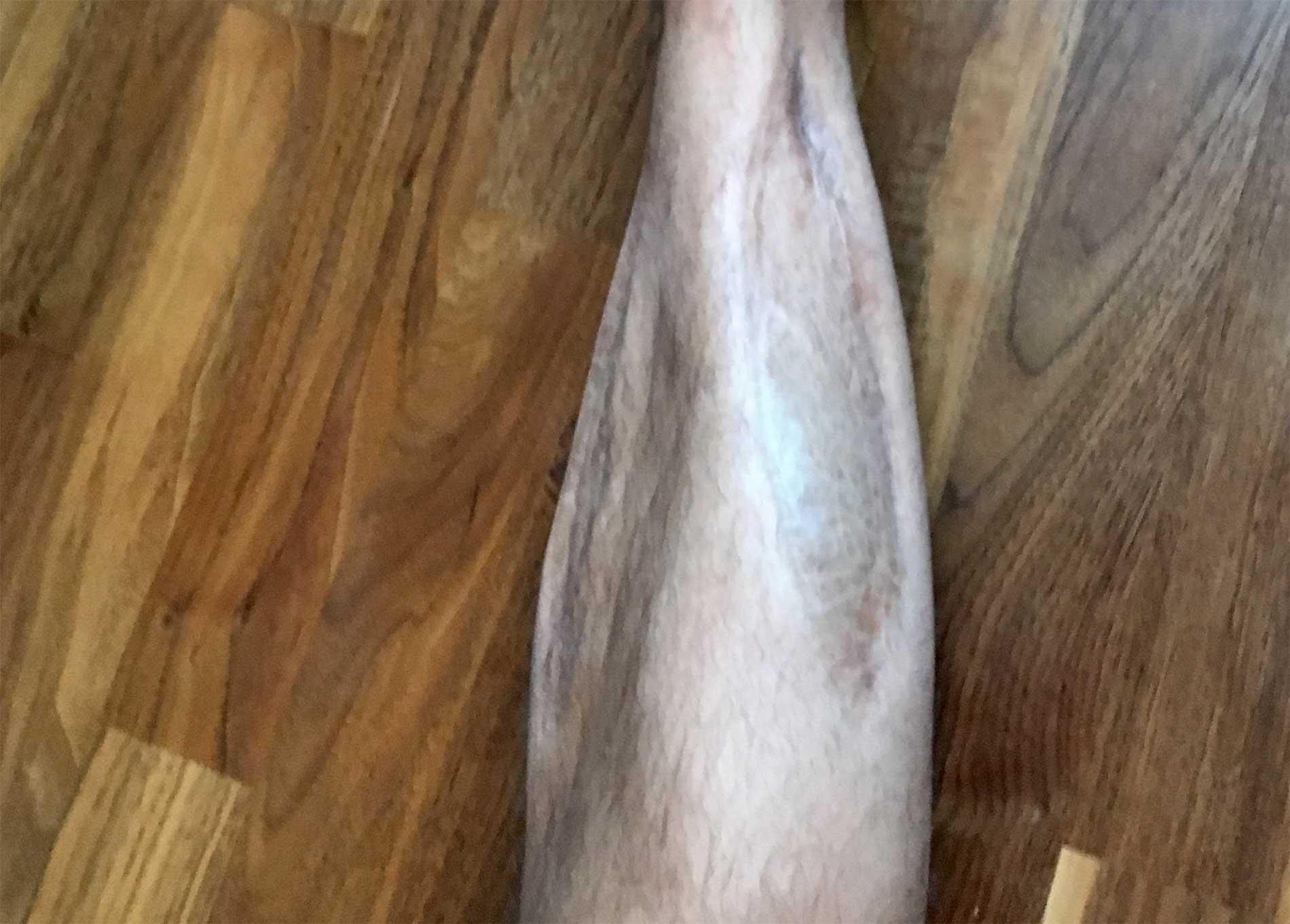 Robbans ben är fortfarande märkt av skadan 1998.
