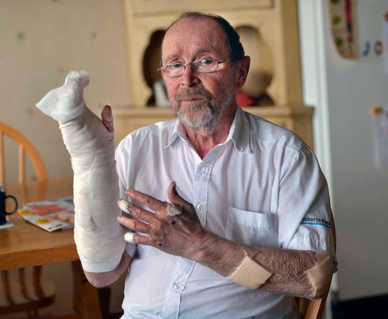 ”Blodet forsade”  Björn Wallén, 73, skulle hjälpa en sjuk man. Då gick kamphunden till attack och bet Björn så att blodet forsade. ”Jag är glad att jag lever efter den värsta pärsen i mitt liv”, säger han.