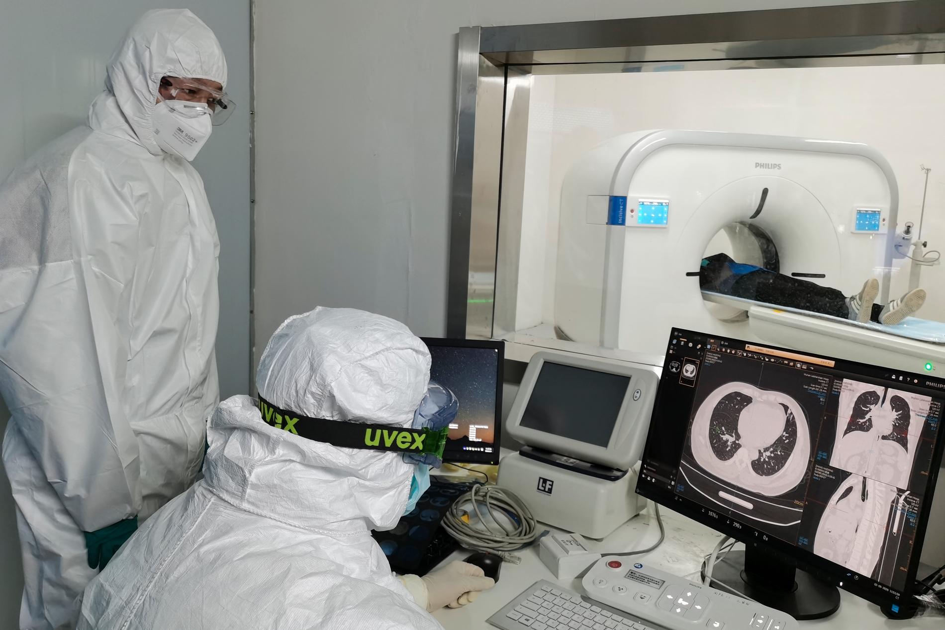 Läkare analyserar röntgenbilder av en patients lungor på ett sjukhus i Wuhan i Hubeiprovinsen.