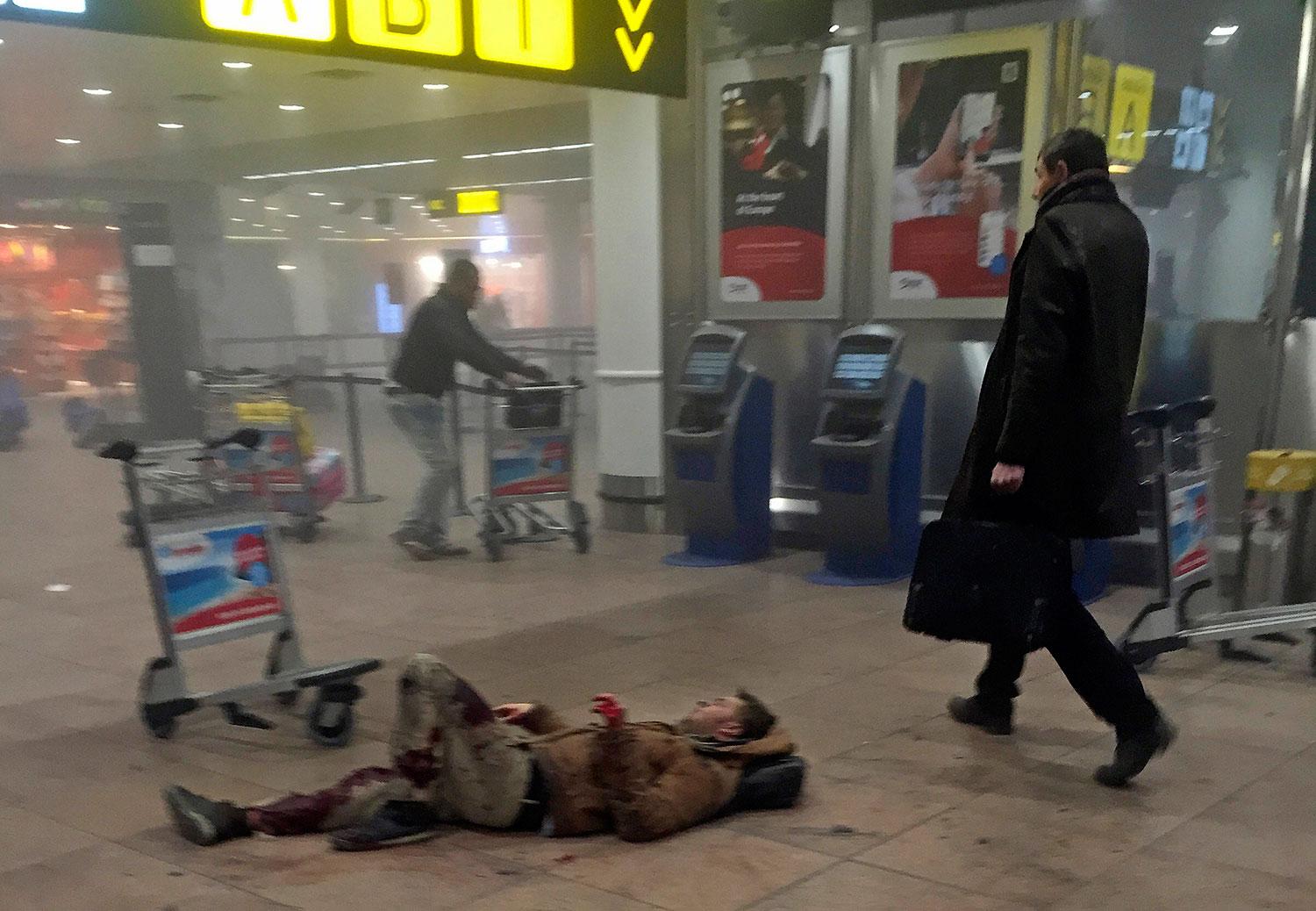 En skadad man väntar på hjälp på flygplatsen i Bryssel efter terrorattacken.