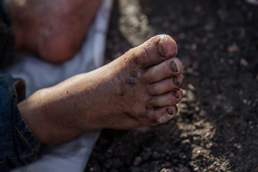 Adnan Alhara får sina fötter omplåstrade av volontärer. Hans fötter är såriga efter många dagar till fots.