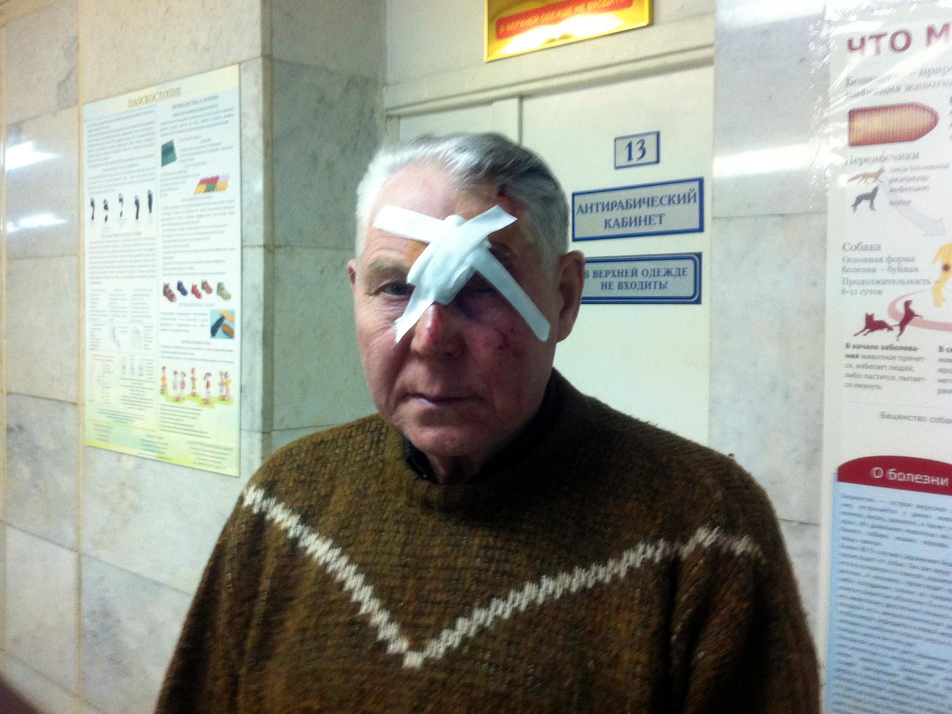 En man som kallar sig "Viktor" har precis behandlats för sina skador efter meteoritnedslaget i Ryssland.