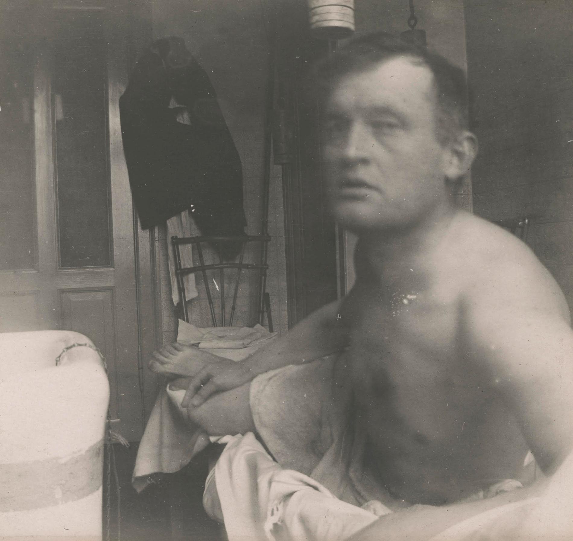 Självporträtt "à la Marat". taget av Edvard Munch på doktor Jakobsons klinik i Köpenhamn 1908–1909. Pressbild.