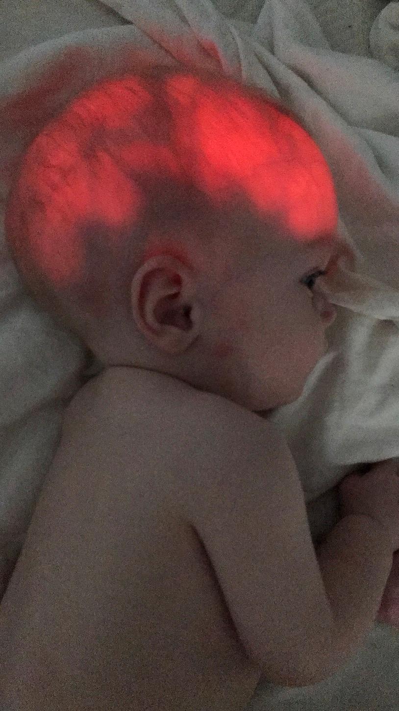 Det röda lampljuset visar Eltons vattenfyllda partier i skallen.
