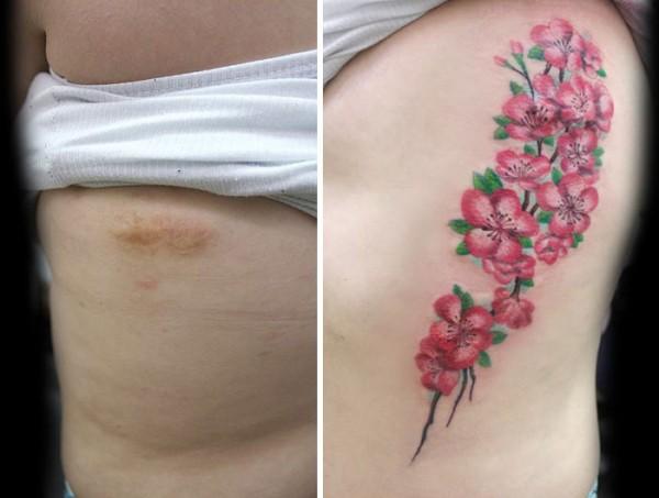Den här kvinnan fick en tatuering för att dölja sin skottskada.