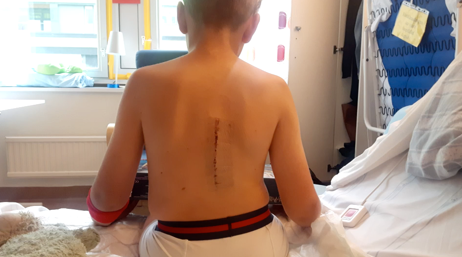 I augusti 2019 opererades Leo för cancer.