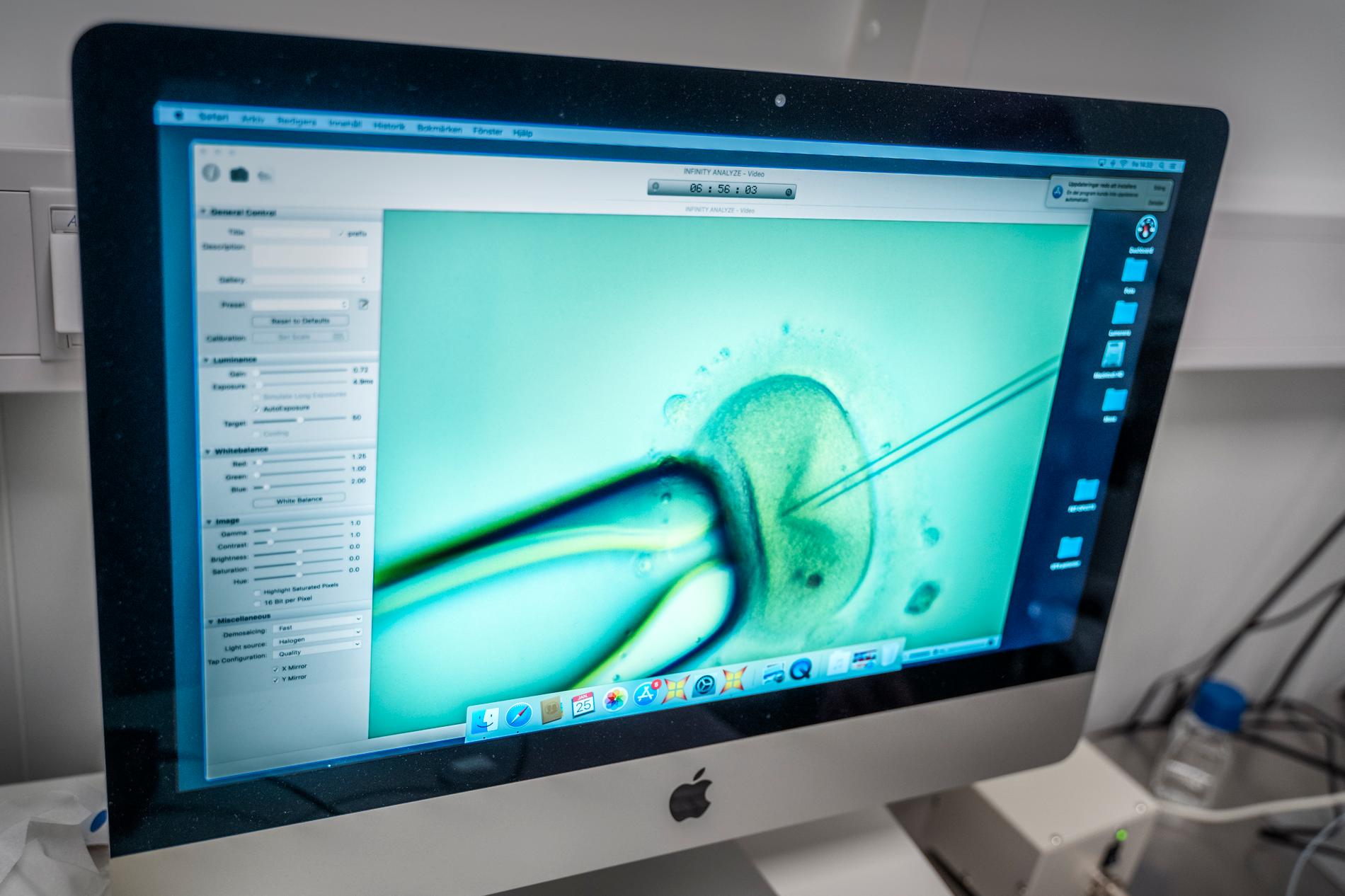 Ett ägg blir befruktat på en IVF-klinik i Sverige vilket visas live på en datorskärm. Arkivbild.