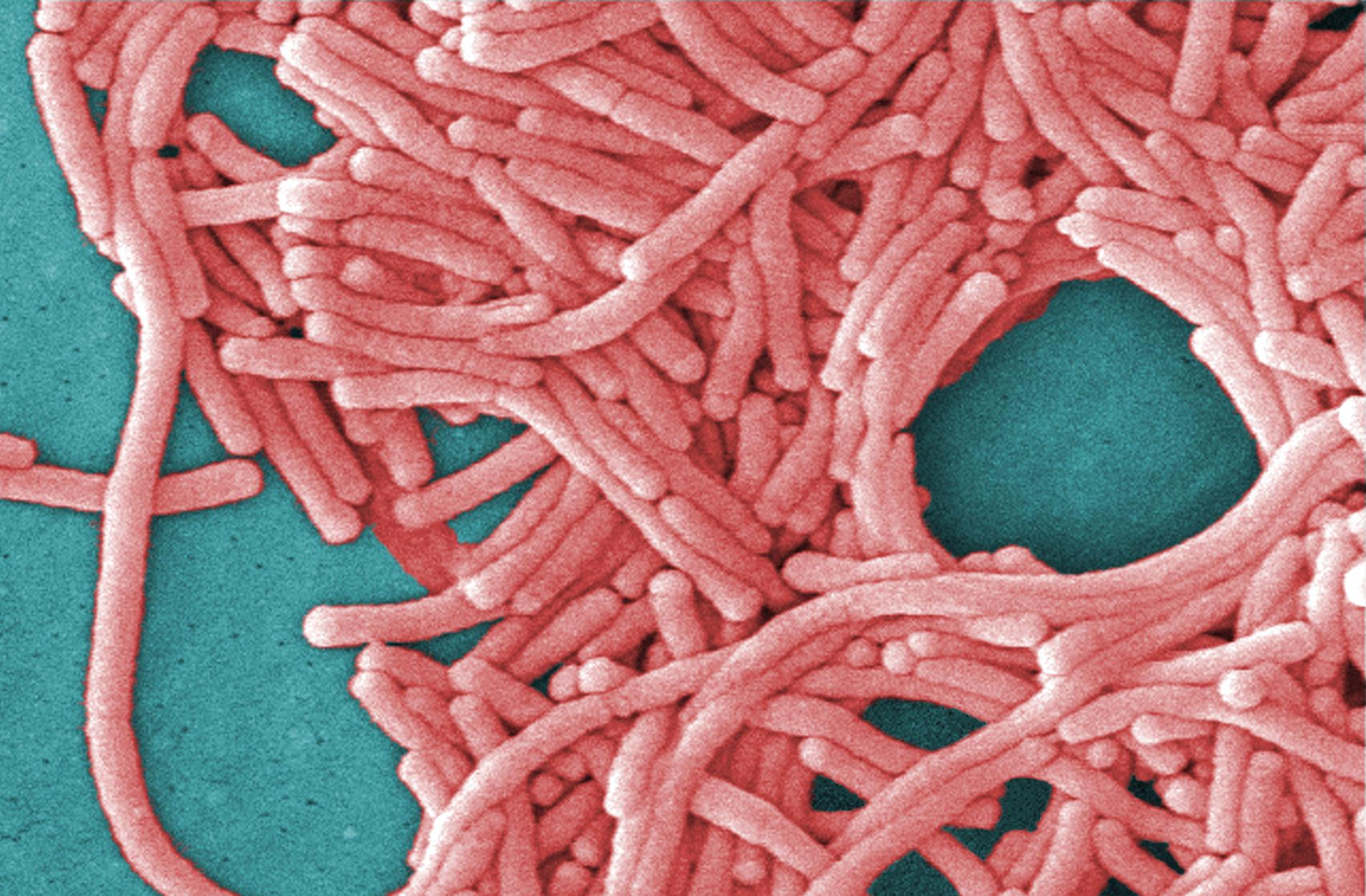 Legionellabakterien är vanligt förekommande i jord och vattensamlingar och kan orsaka allvarlig lunginflammation.