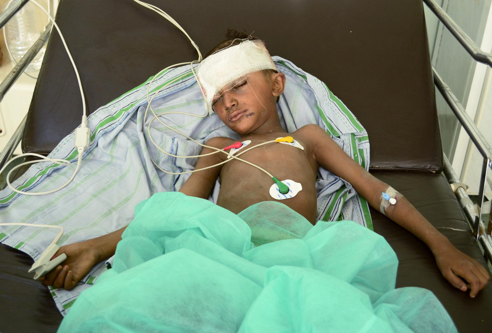 En pojke som skadats i ett saudiskt flyganfall på sjukhus i Houdieda.