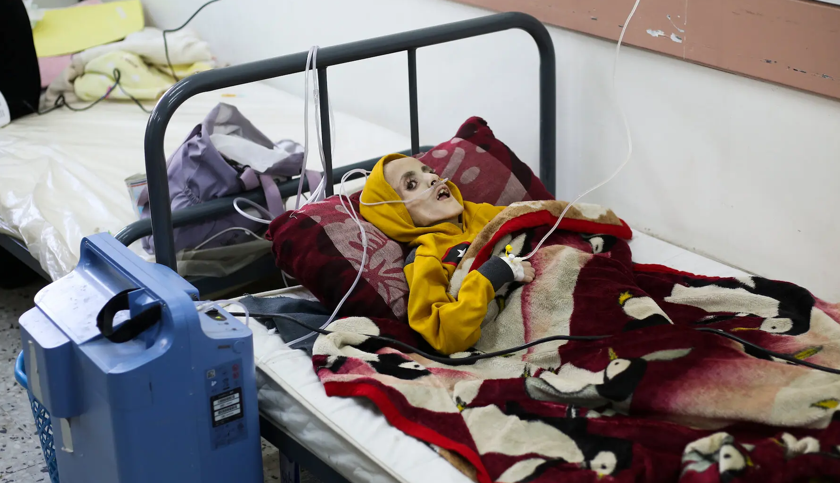10-årige Yazan dog på sjukhuset i Gaza.