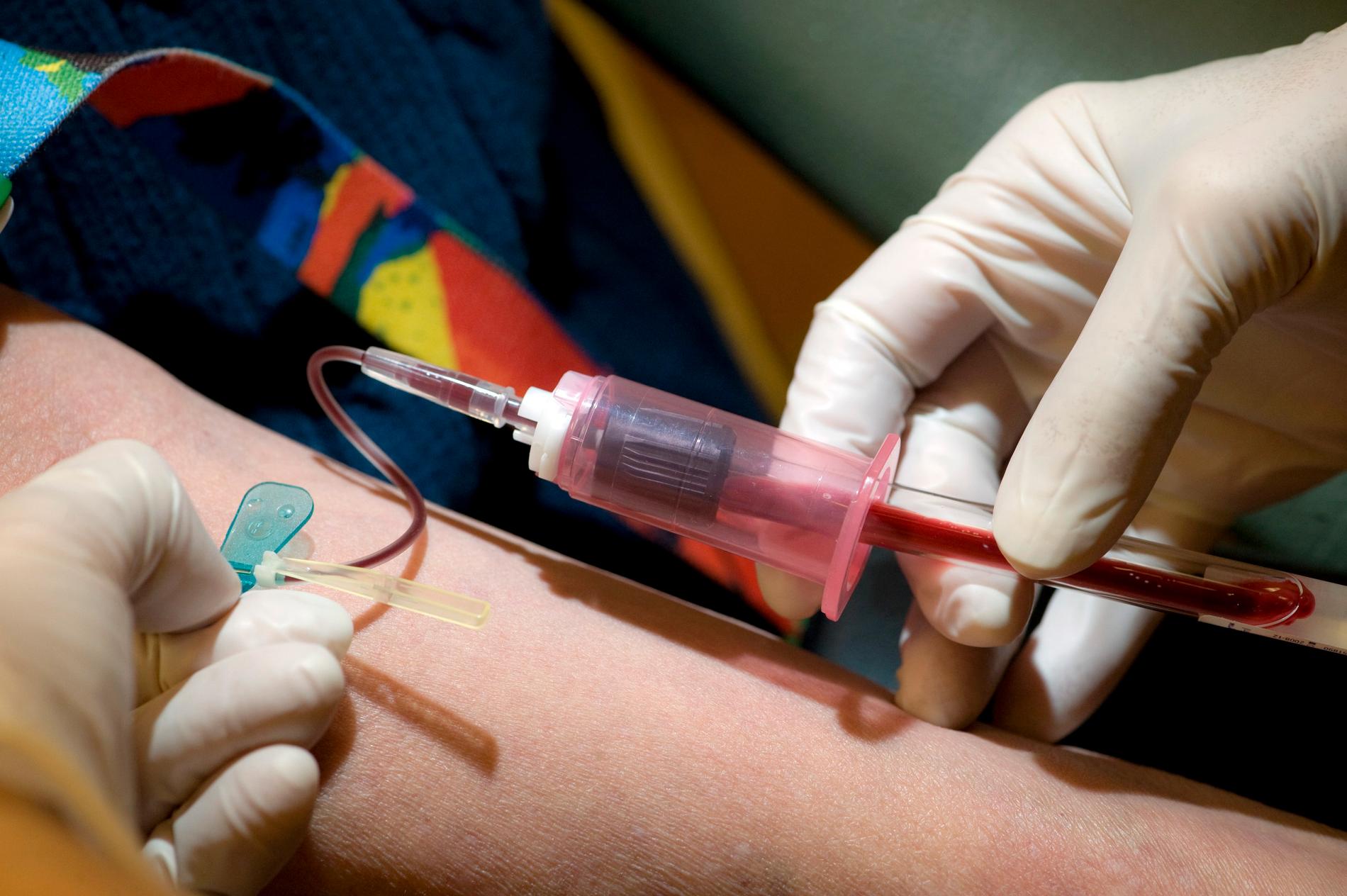 PSA-testet genomförs med hjälp av blodprov. Arkivbild.