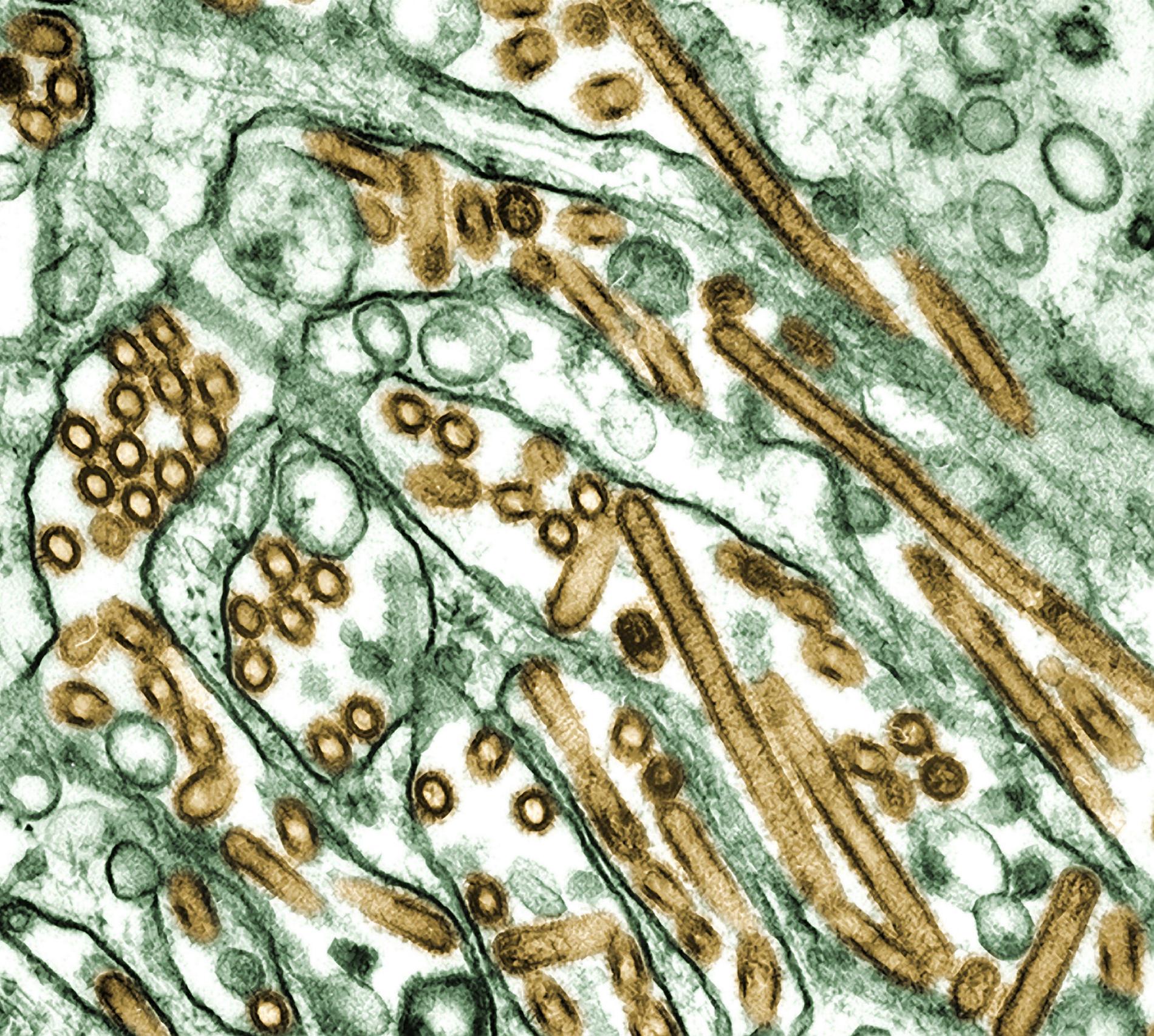 H5N1-virus som ger fågelinfluensa av den typ som även drabbar människor. Arkivbild.