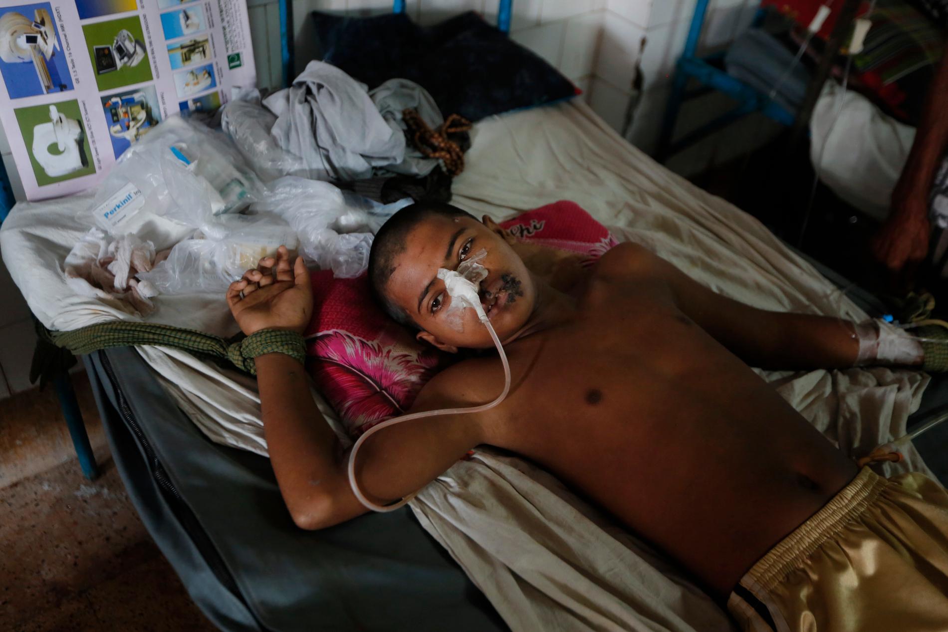 Den 15-årige rohingyapojken Mohammad Junayed får vård för en skottskada på ett sjukhus i Chittagong, Bangladesh.