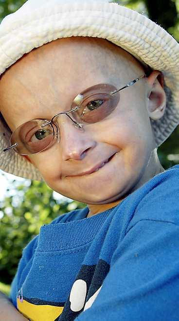 ETT BARN PÅ ÅTTA MILJONER DRABBAS Jesper, 6, har progeria - en sjukdom som gör att han åldras tio gånger snabbare än normalt.