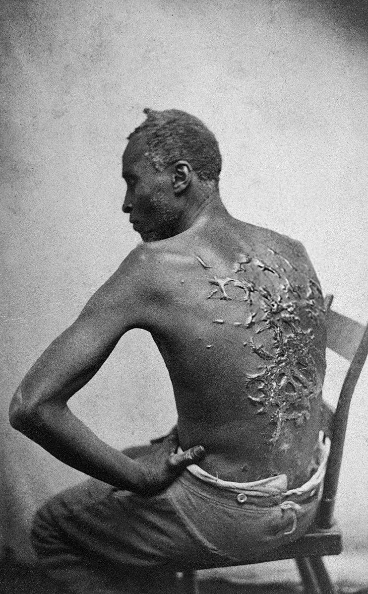 Verklighetens ”Whipped Pete”, slaven Gordon, fotograferad 1863.