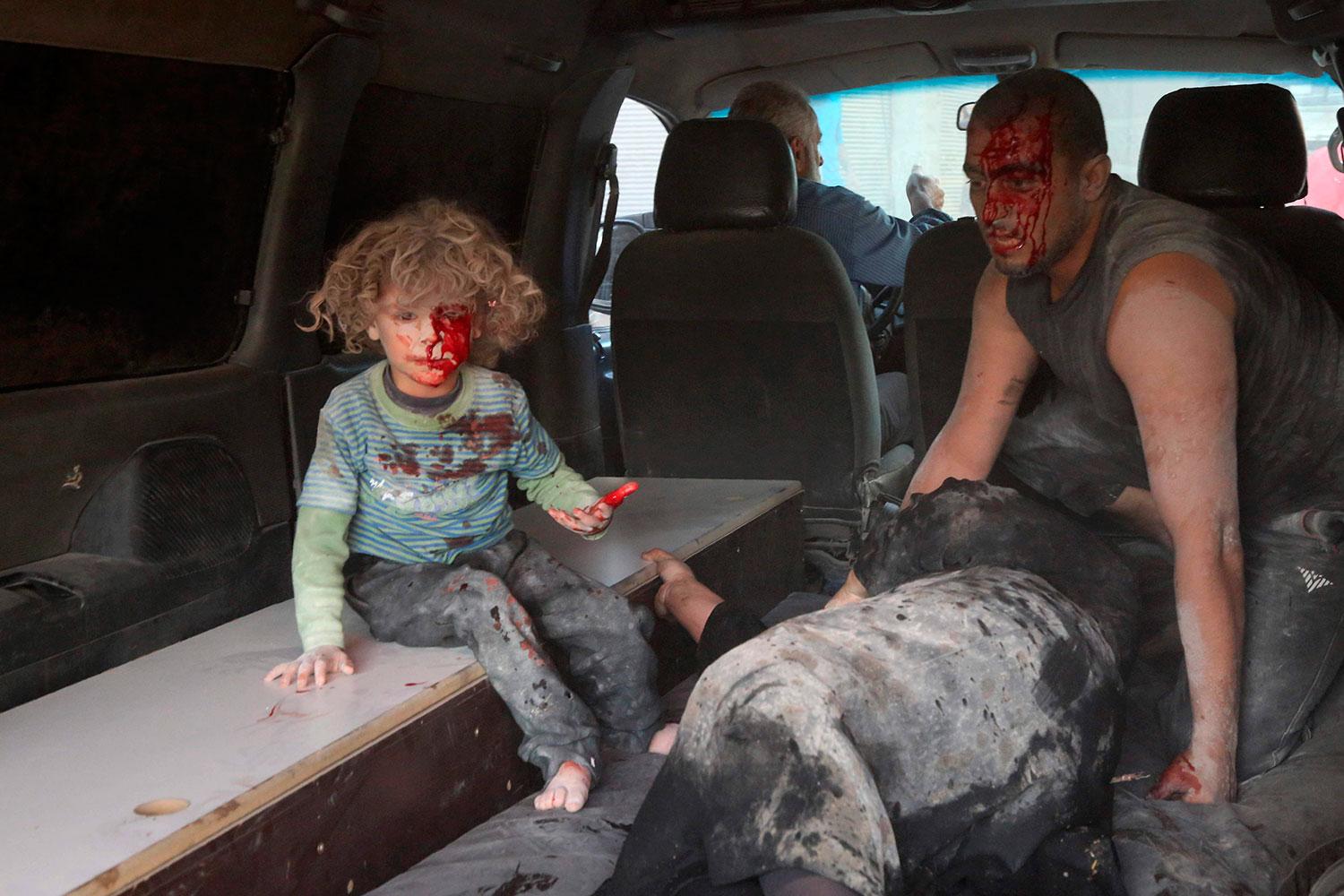 Ett skadat barn, en skadad kvinna och en skadad man i Kafr Batna strax utanför Damaskus. De har bombats av regimen eller Ryssland.