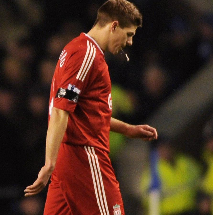 Steven Gerrard drog på sig en bristning i ena låret i mötet med Everton.