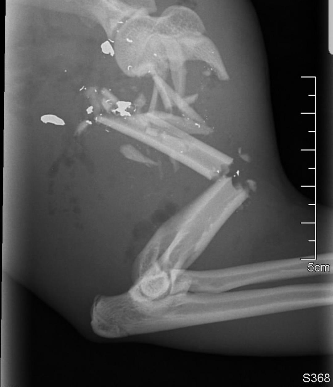 Röntgenbilderna efter händelsen visar att Missens ben var helt krossat.