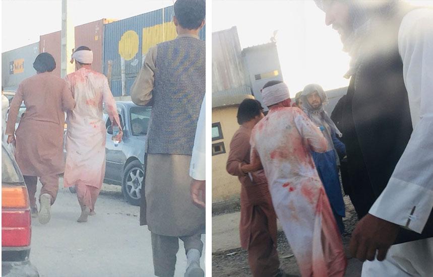 Bilder som sägs visa skadade personer vid Abbey Gate vid Hamid Karzai Airport i Kabul.
