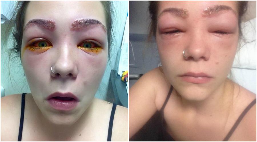 Tyah fick allergisk reaktion av bryn och fransfärg. Höll på att kosta henne synen.