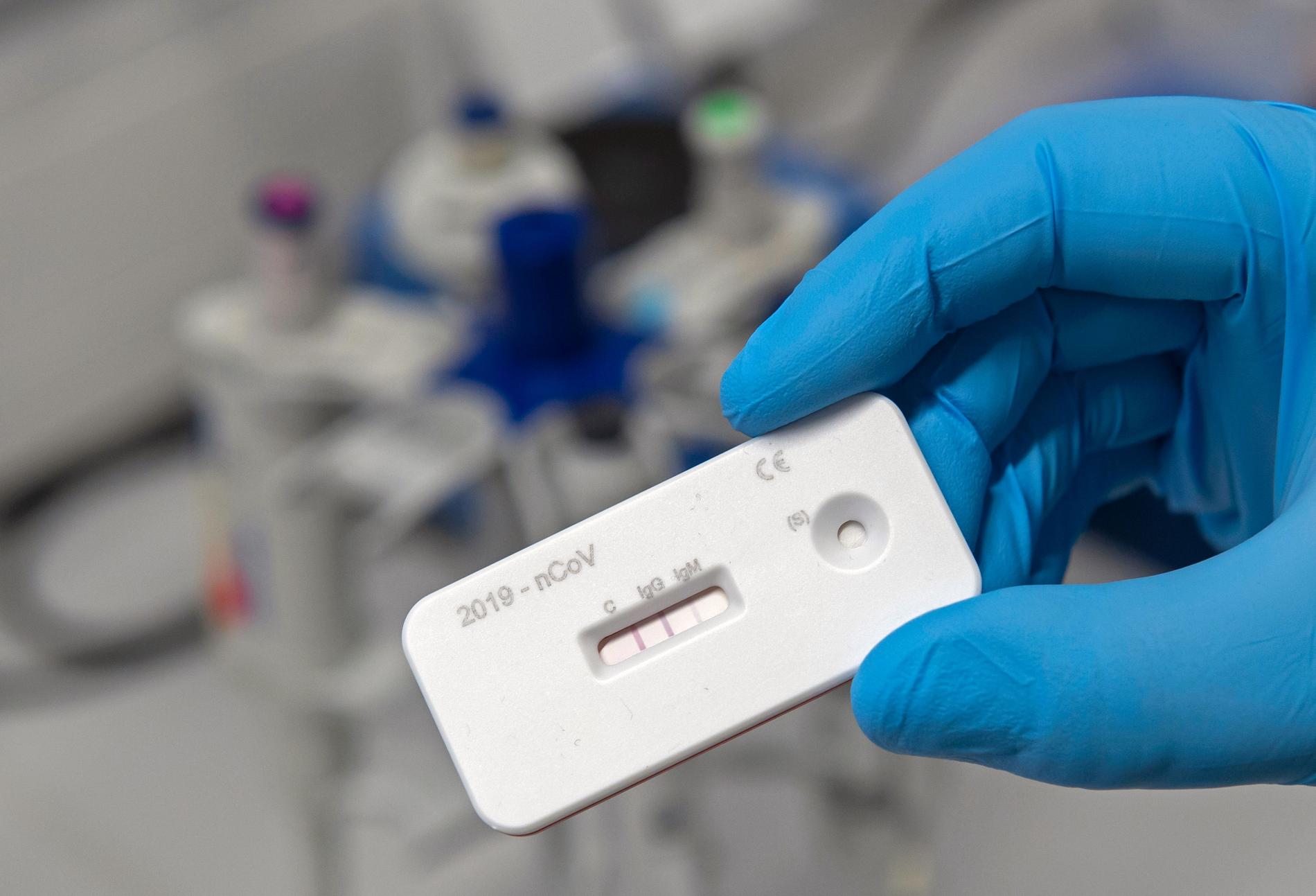 En forskare visare upp ett antikroppstest i ett tyskt laboratorium.