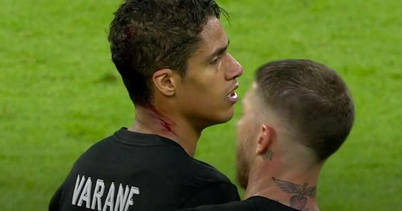 Raphael Varane zoomades in i samband med att åskådare stormade planen. Real-spelaren slogs dock blodig i en situation precis före slutsignalen.
