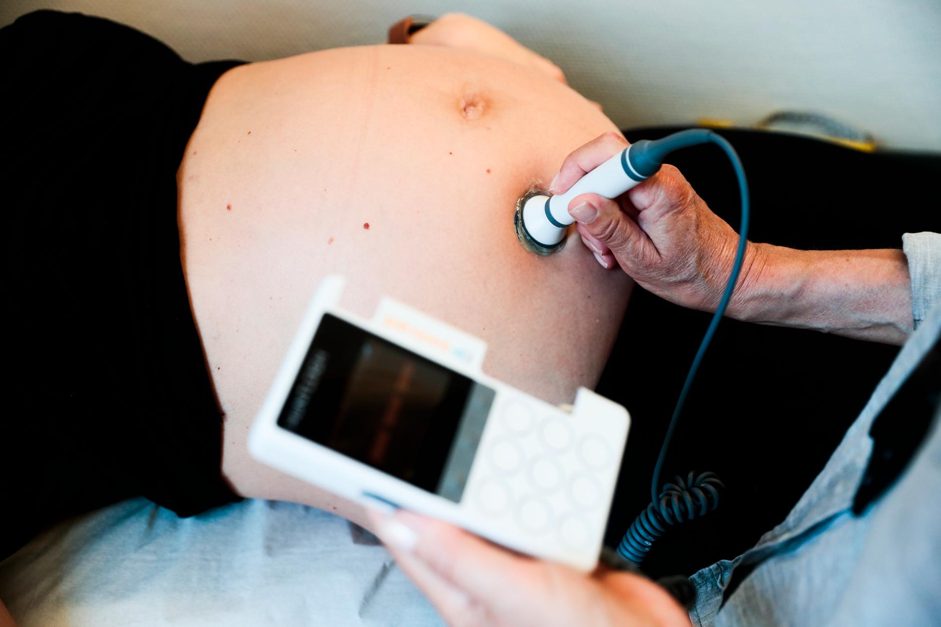 Ett fåtal sjukhus har ändrat sina rutiner kring igångsättning av förlossning. Arkivbild.