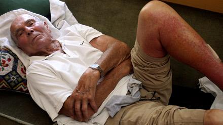 FICK HÖG FEBER Simturen i det varma vattnet höll på att kosta Sten Ruben, 88, livet. Han fick 41 graders feber och vårdades på sjukhus en vecka. – De där basseluskerna fanns överallt, säger han.
