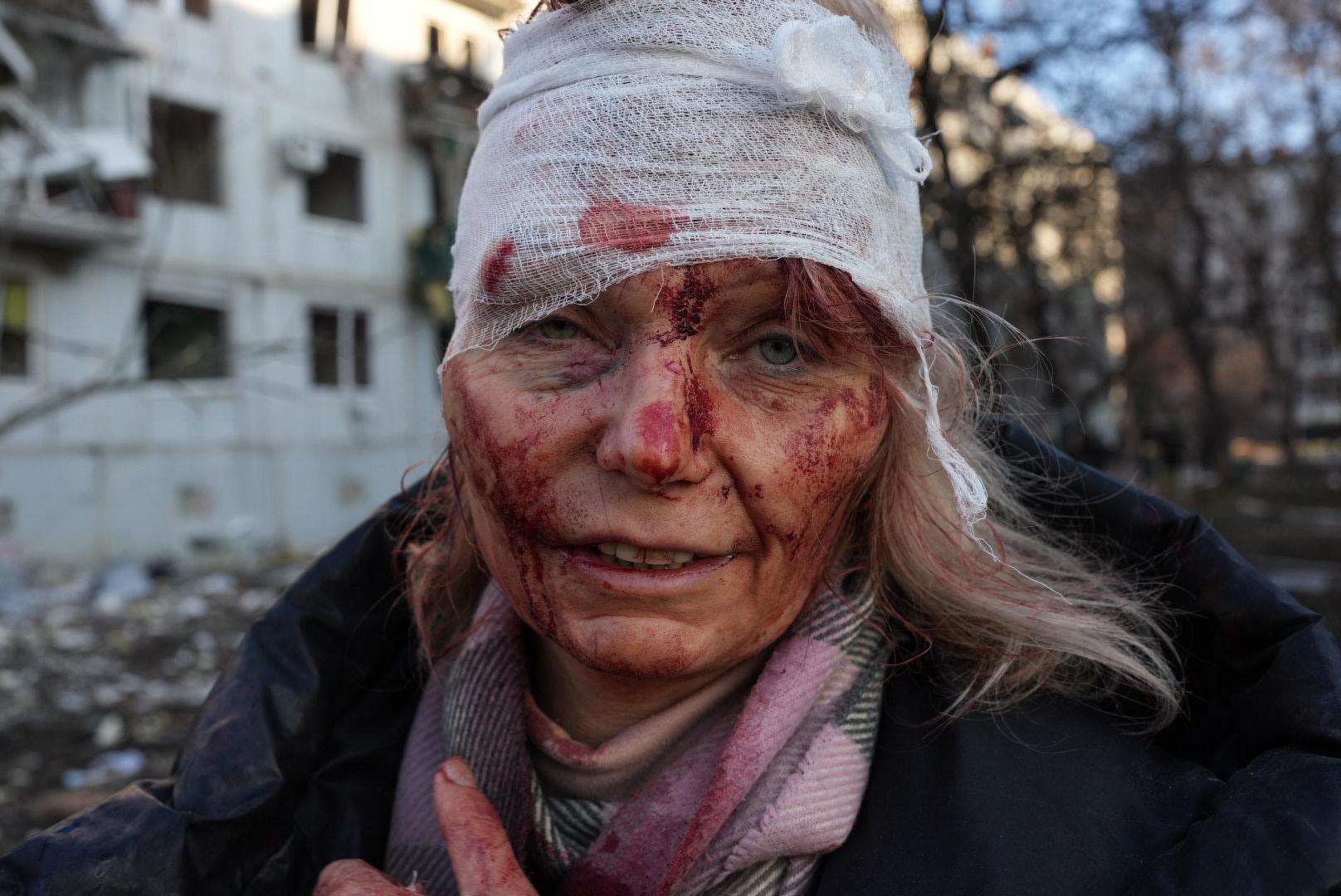 En skadad kvinna med blodigt ansikte utanför staden Charkiv.