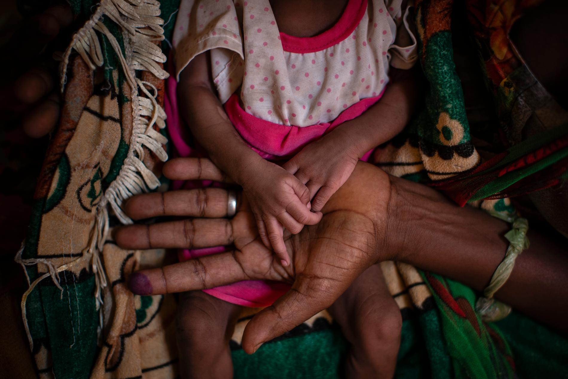 En mamma med sin undernärda dotter i ett behandlingstält i regionen Tigray i norra Etiopien. Arkivbild.