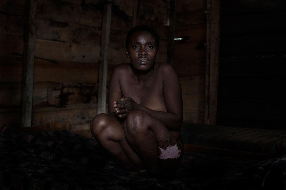 NICLAS HAMMARSTRÖM Georgette Byabaima, 44, blev våldtagen och torterad i sin by i Kongo av fem milismän.