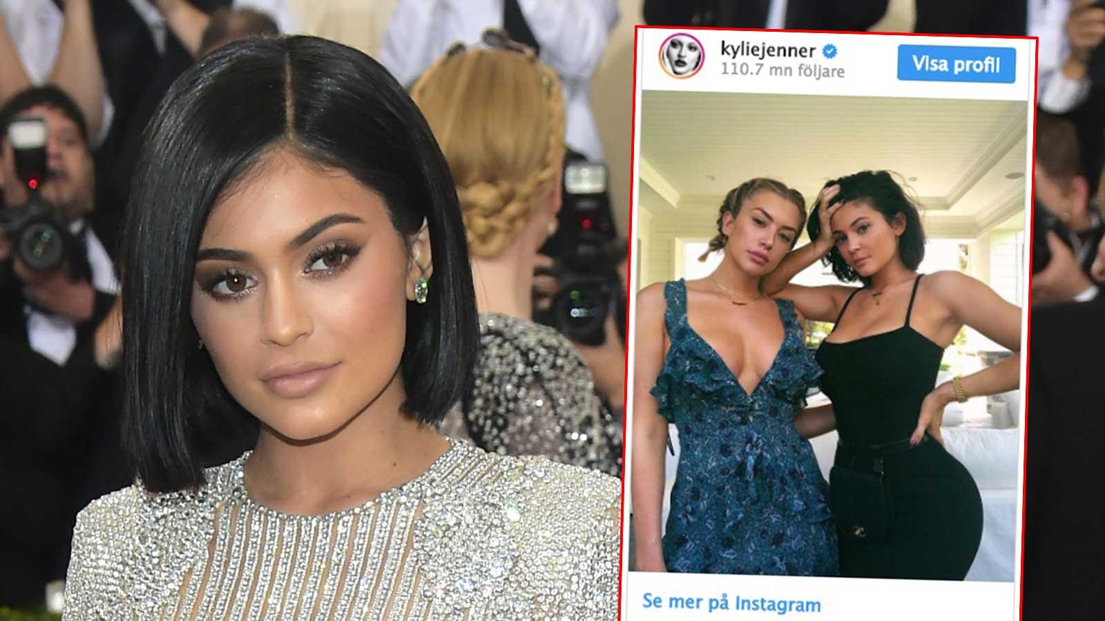 Kylie Jenner före och efter ingreppet.