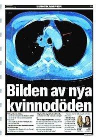 Gårdagens artikel Aftonbladets artikelserie Lungkampen började i går med cancersjuka Cecilia, Ingrid och Anita.