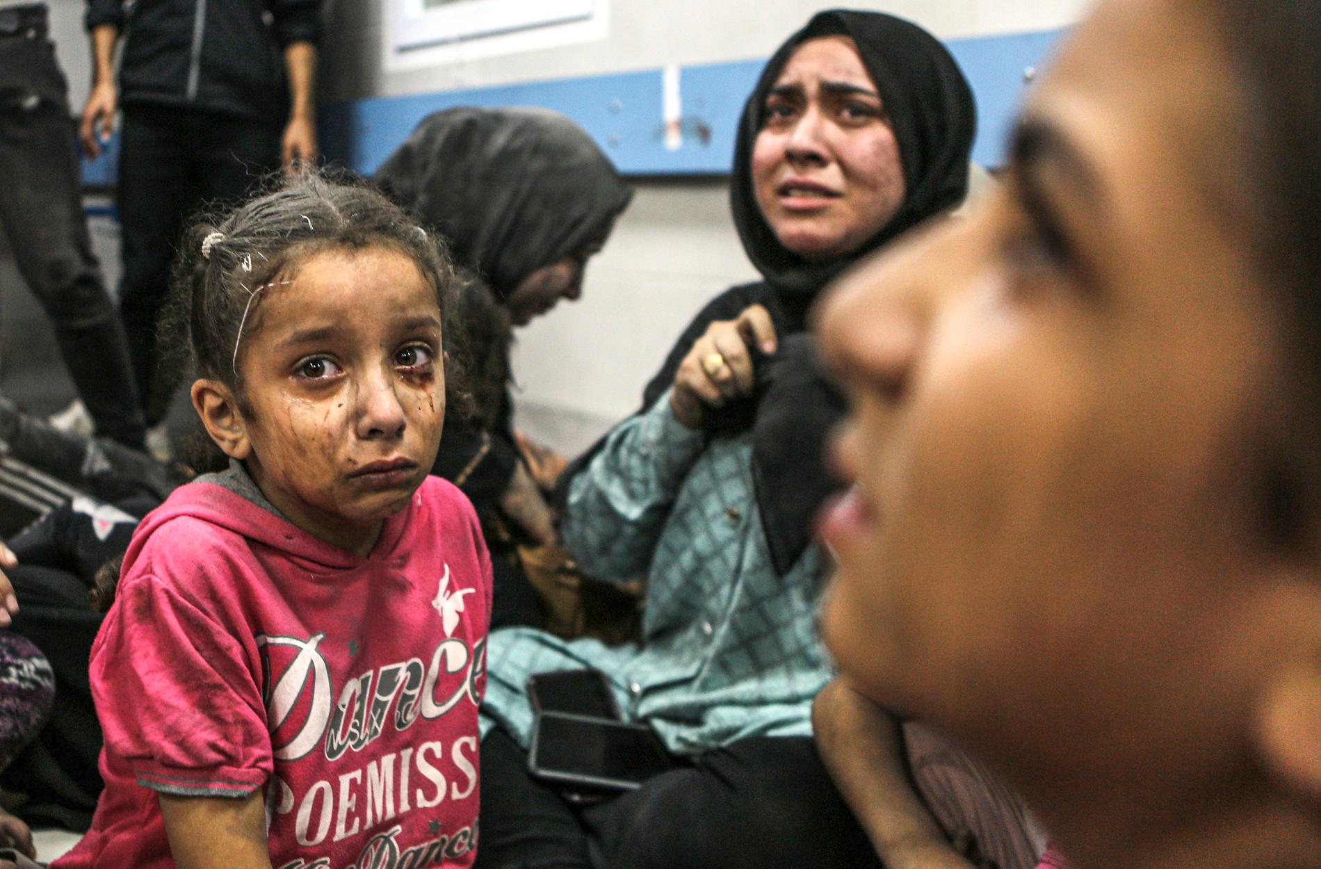 Sårade palestinier sitter på al-Shifa-sjukhuset i Gaza City, centrala Gazaremsan, efter att ha anlänt från al-Ahlis sjukhus efter en explosion.