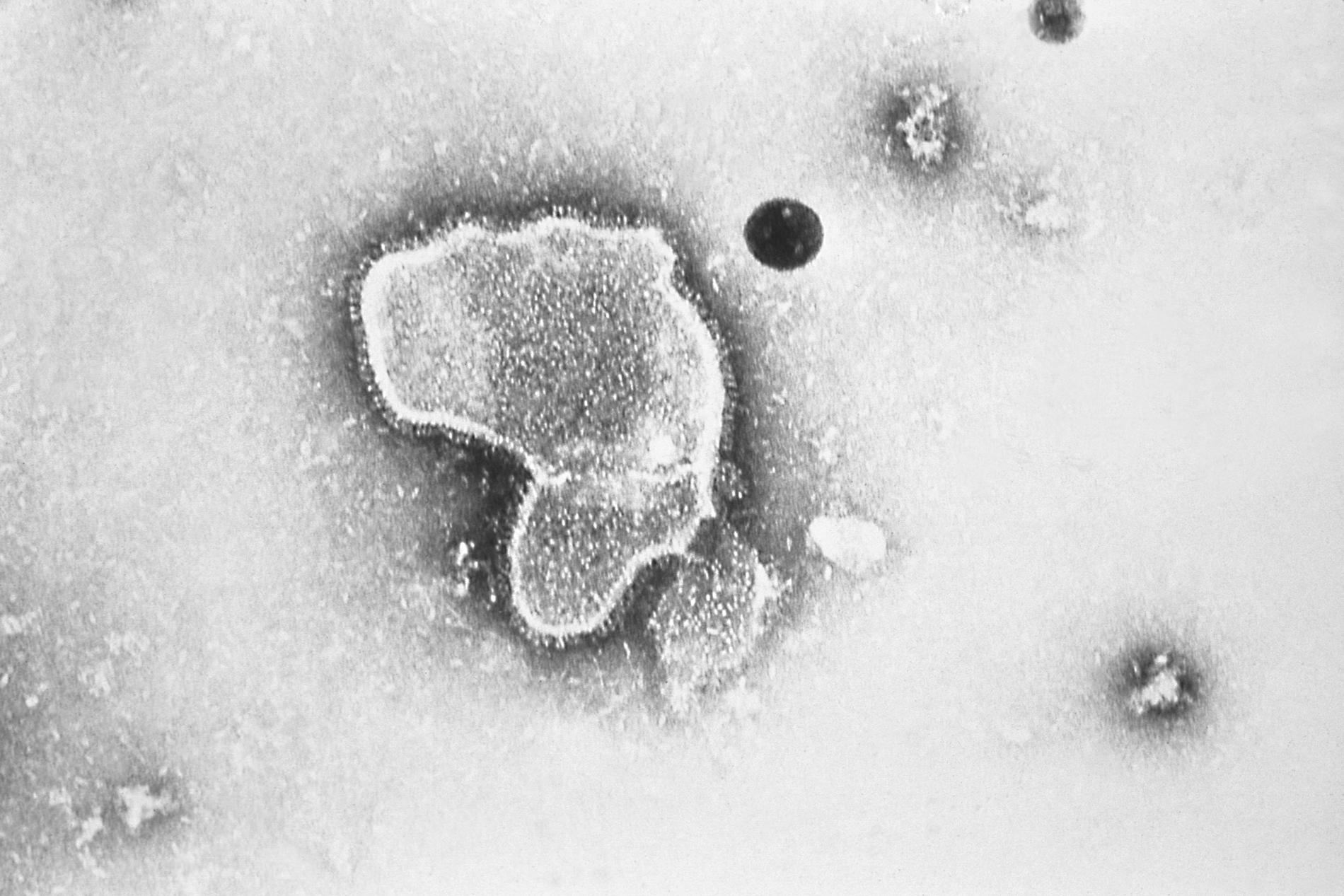 Mikroskopbild på RS-viruset. 