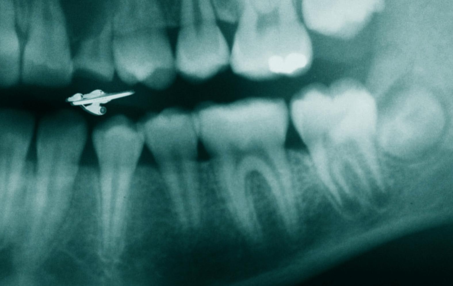 Oron för tandläkarbesöket minskade när Andrev Walden fick lära sig tandläkarspråket och upptäckte kopplingen mellan tandraden och rymdfilmer.