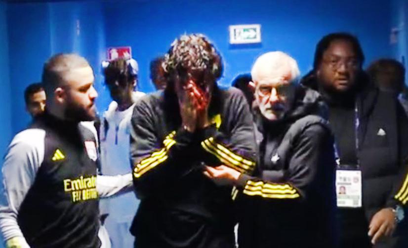 Lyons tränare Fabio Grosso blodig i ansiktet efter stenattacken.