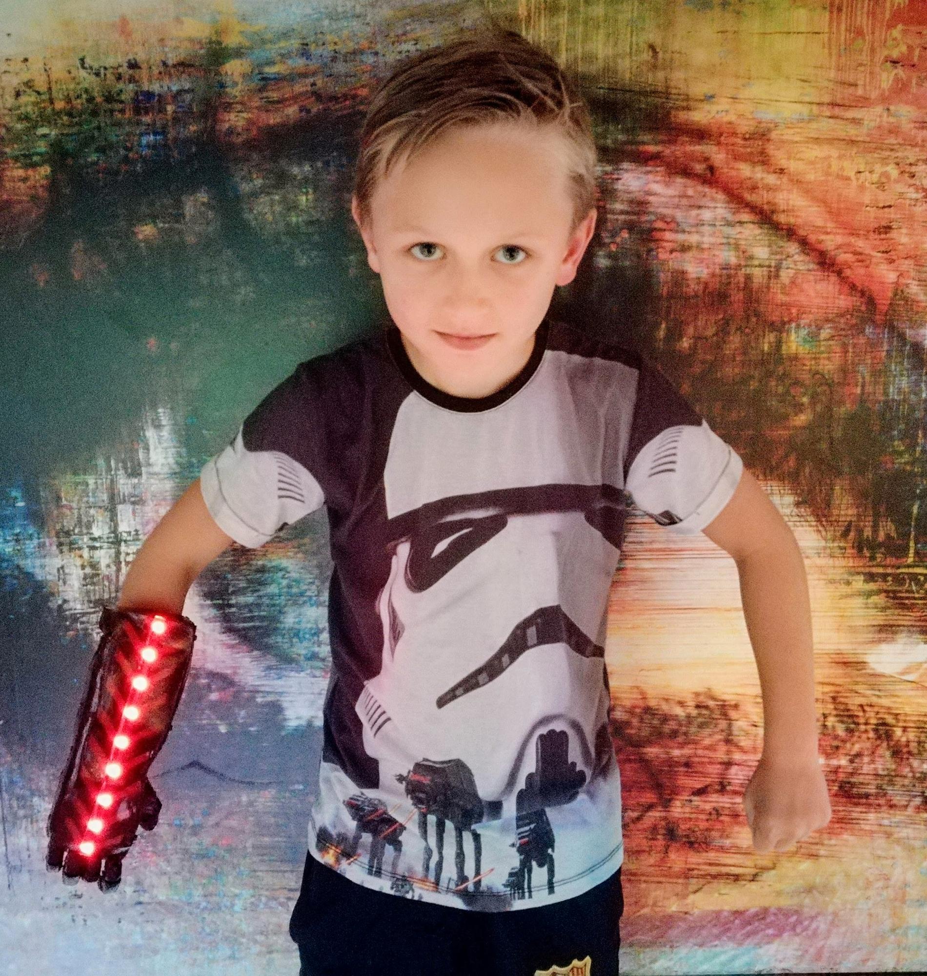 8-åriga Marc kan både leka och utföra vardagssysslor med sin robothand. 