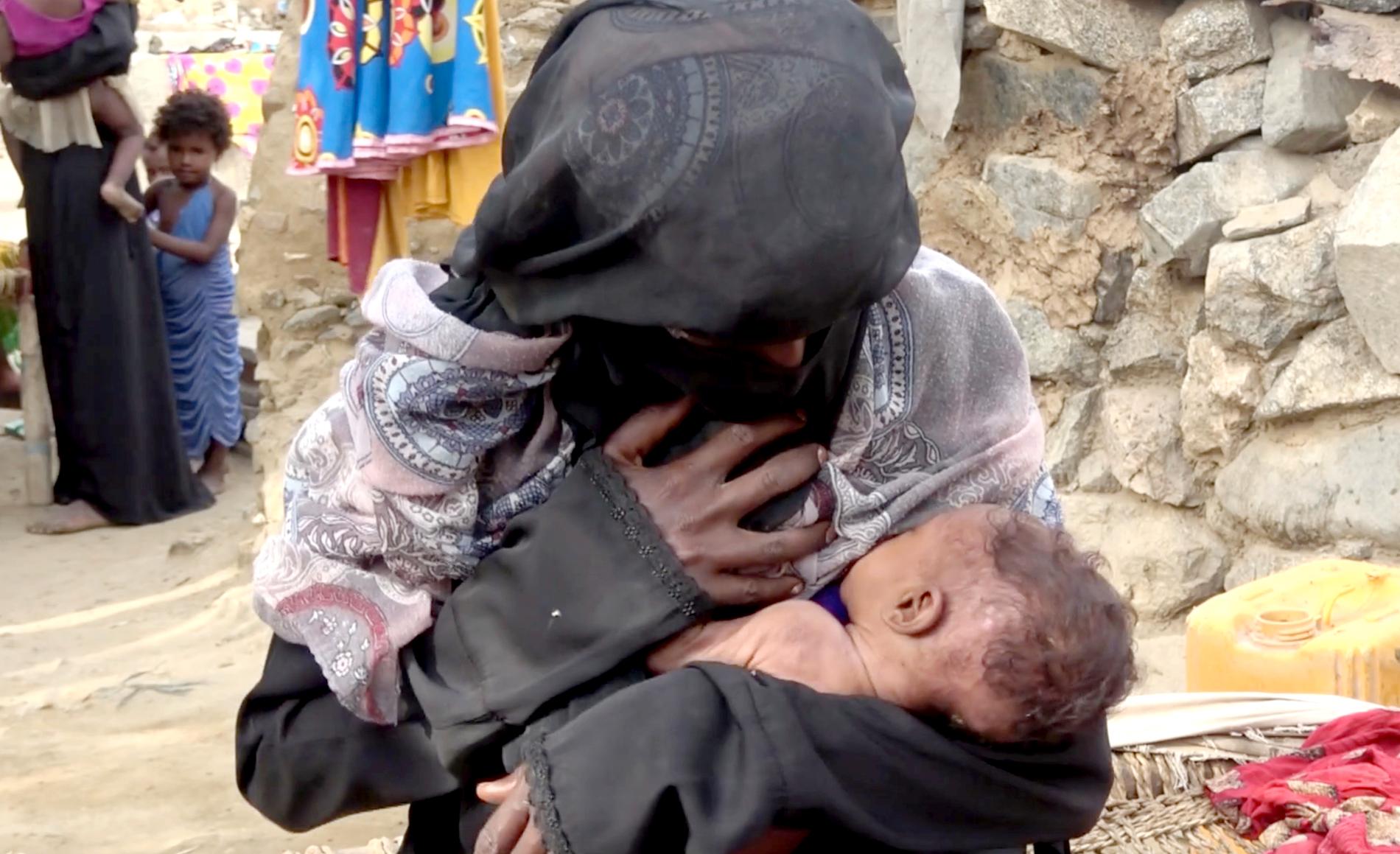 Det svårt undernärda spädbarnet Zahara ammas av sin mamma i staden Aslam i Jemen i augusti 2018.