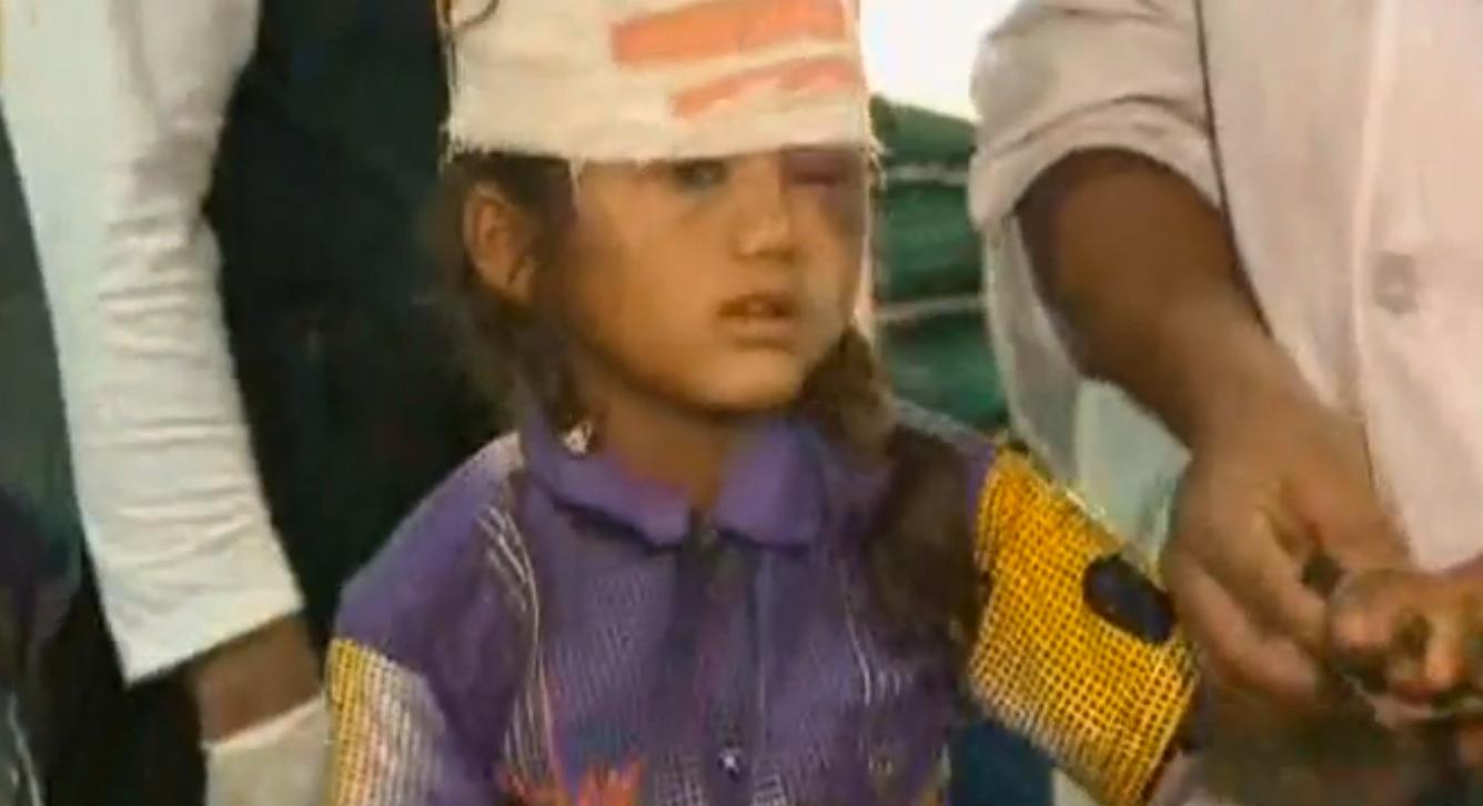 8-åriga flickan är på bättringsvägen. Foto: Faksimil CNN.